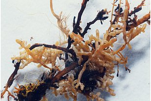 Feinwurzeln einer Buche. Die hellen Wurzelspitzen sind lebendig, die schwarzen Wurzelspitzen sind tot. (Foto: Anika Richter/WSL)