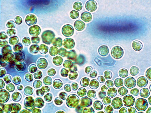 Certain types of green algae live in glacial soil and permafrost. (Photo: Beat Frey) 