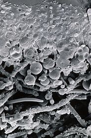 Querbruch eines gefroren-hydratisierten Lagers der Lungenflechte Lobaria pulmonaria. Die kugeligen Algen und die fädigen Pilzhyphen der beiden Symbiosepartner sind deutlich sichtbar. Bild: Christoph Scheidegger, WSL