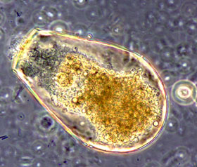 Mixotrophic Examples Tiny amoebas could play a big role in climate